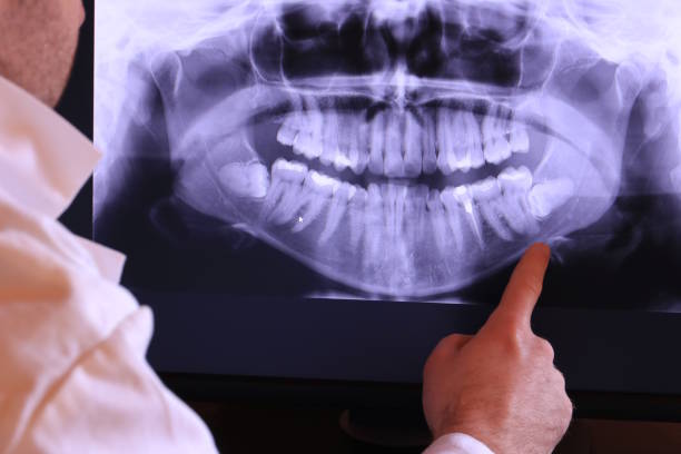 Best Tooth Infection Emergency Dentist  in Gentry, AR